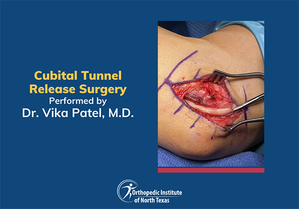 Cubital Tunnel Release Surgery