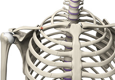 Distal Clavicle Excision