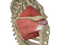 Massive Retracted Rotator Cuff Tear