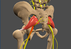 Sciatica