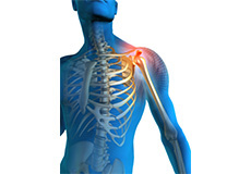 shoulder Pain