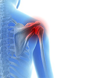 Throwing Injuries Of The Shoulder