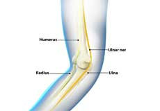 Ulnar Nerve Transposition